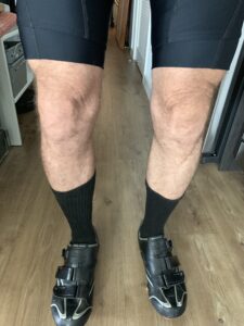 Tom Ford says I shouldn't wear shorts, but my legs are nice